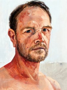Self Portrait with sun damage, 2014 by Andrew Sayers. Self Portrait with sun damage, 2014 by Andrew Sayers.