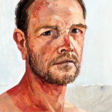 Self Portrait with sun damage, 2014 by Andrew Sayers. Self Portrait with sun damage, 2014 by Andrew Sayers.