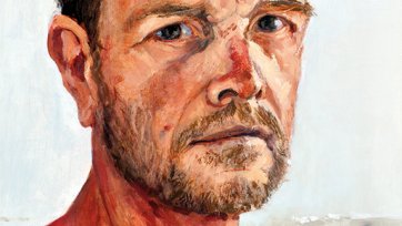 Self Portrait with sun damage, 2014 by Andrew Sayers. Self Portrait with sun damage, 2014 by Andrew Sayers.